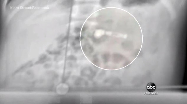 ����AirPods��ô�죿���ģ������������� 